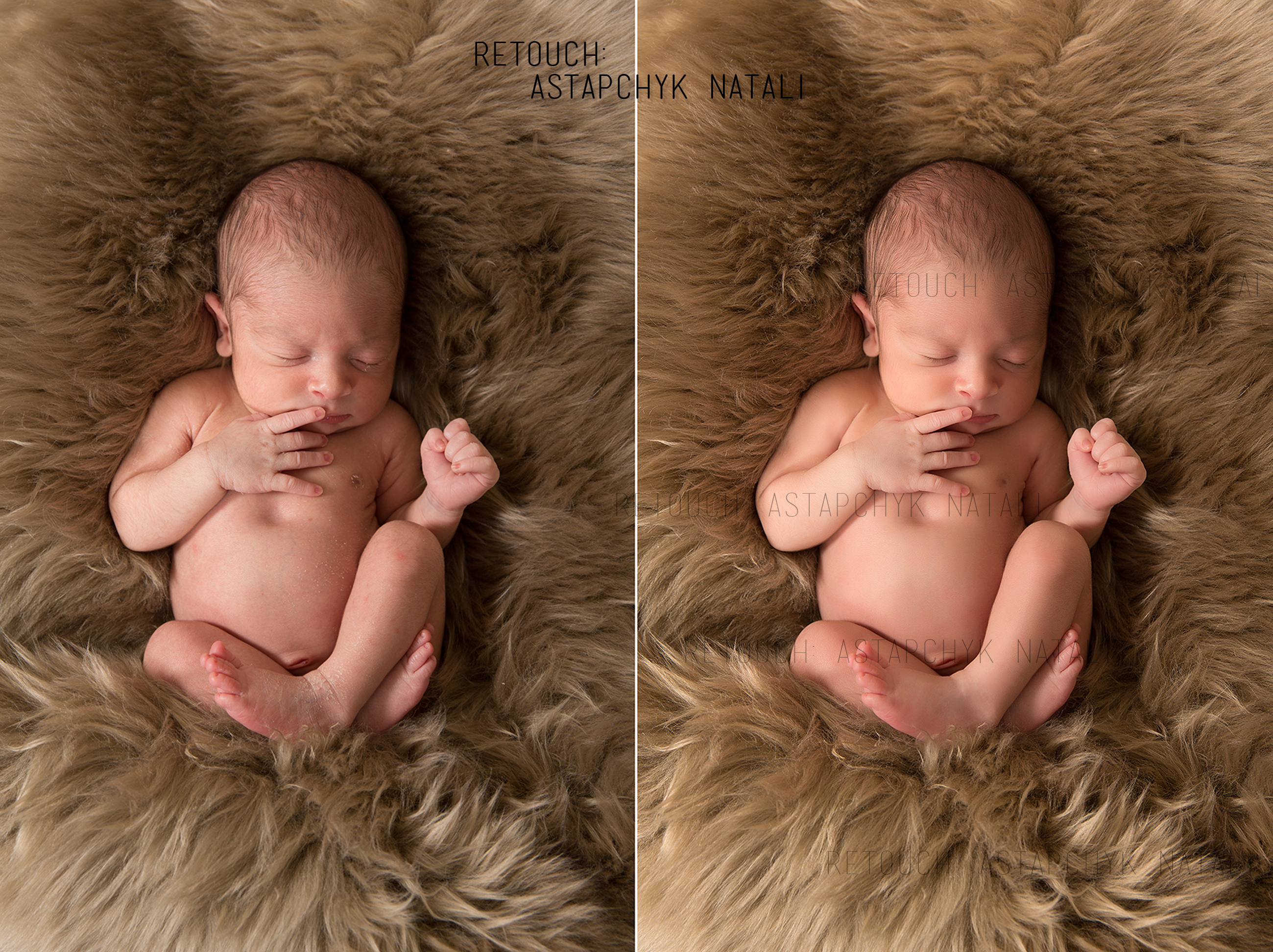 Обработка новорожденных