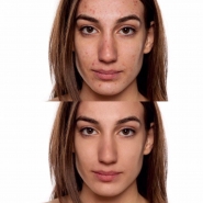 Ретушь фото